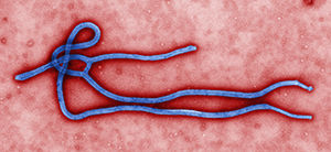 This undated file image made available by the CDC shows the Ebola Virus.