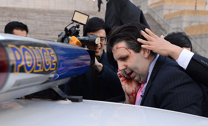 Injured U.S. Ambassador to South Korea Mark Lippert, center, gets into a car to leave for a hospital on March 5, 2015. Lippert was injured by a blade-wielding attacker. An armed man shouted, No to war training! before attacking him, the Yonhap news agency reported.