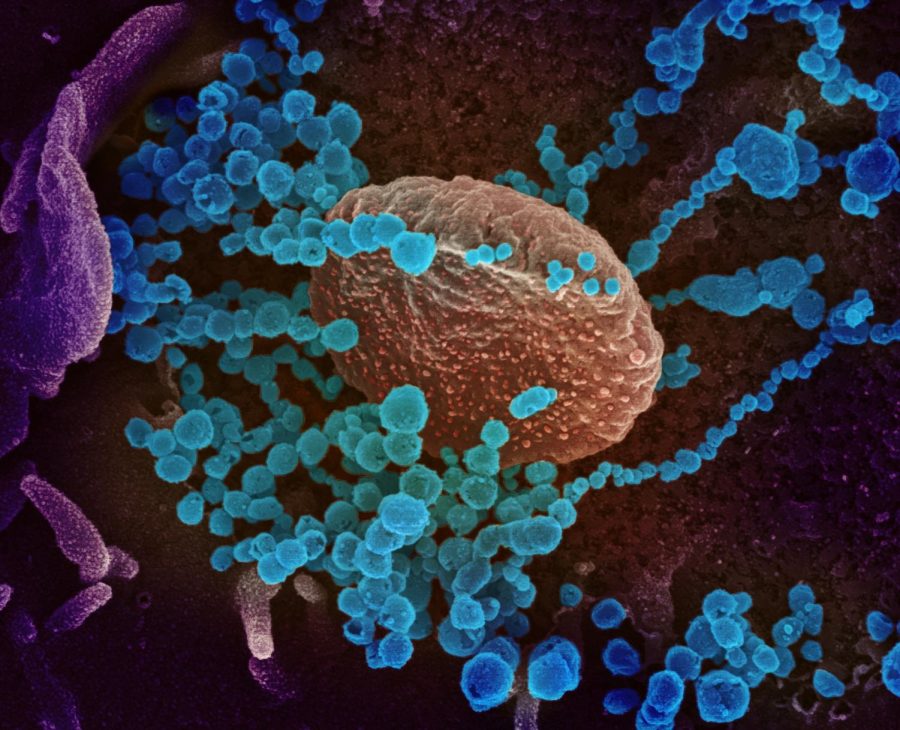 This scanning electron microscope image shows SARS-CoV-2 (round blue objects) emerging from the surface of cells cultured in the lab. SARS-CoV-2, also known as 2019-nCoV, is the virus that causes COVID-19. The virus shown was isolated from a patient in the U.S.
