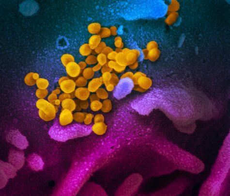 This scanning electron microscope image shows SARS-CoV-2 (yellow)—also known as 2019-nCoV, the virus that causes COVID-19—isolated from a patient in the U.S., emerging from the surface of cells (blue/pink) cultured in the lab. 