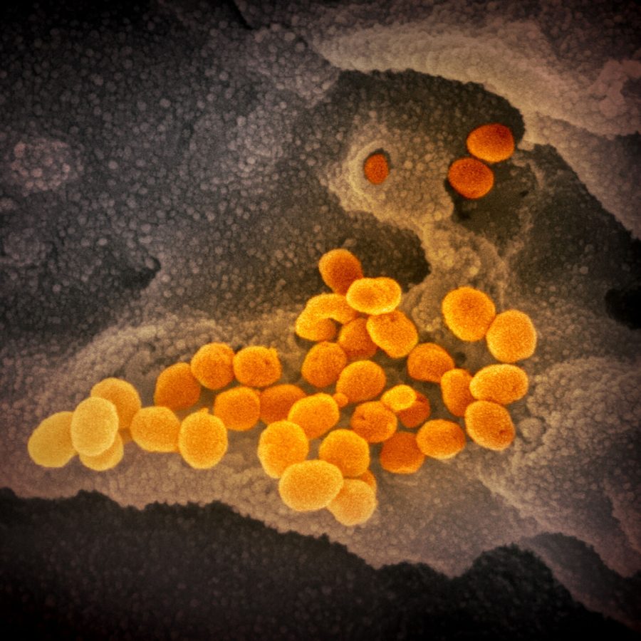 Fauci: US may see surge upon surge of virus in weeks ahead
