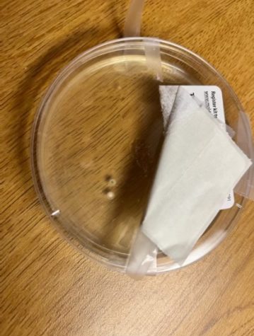 A petri dish shows the results of student Hailey Adams at-home mold kit test. Adams is a resident of Manchester Hall.